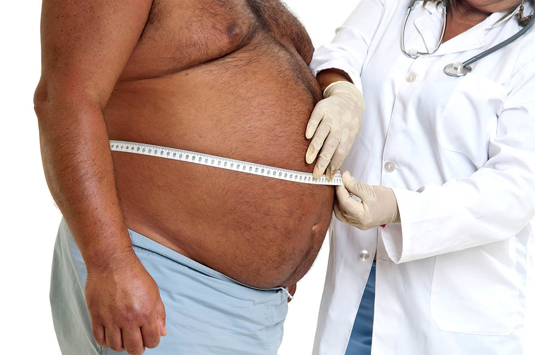 Obeso, malattie del respiro e apnee sonno