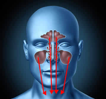 Sindrome Sinuso-Bronchiale