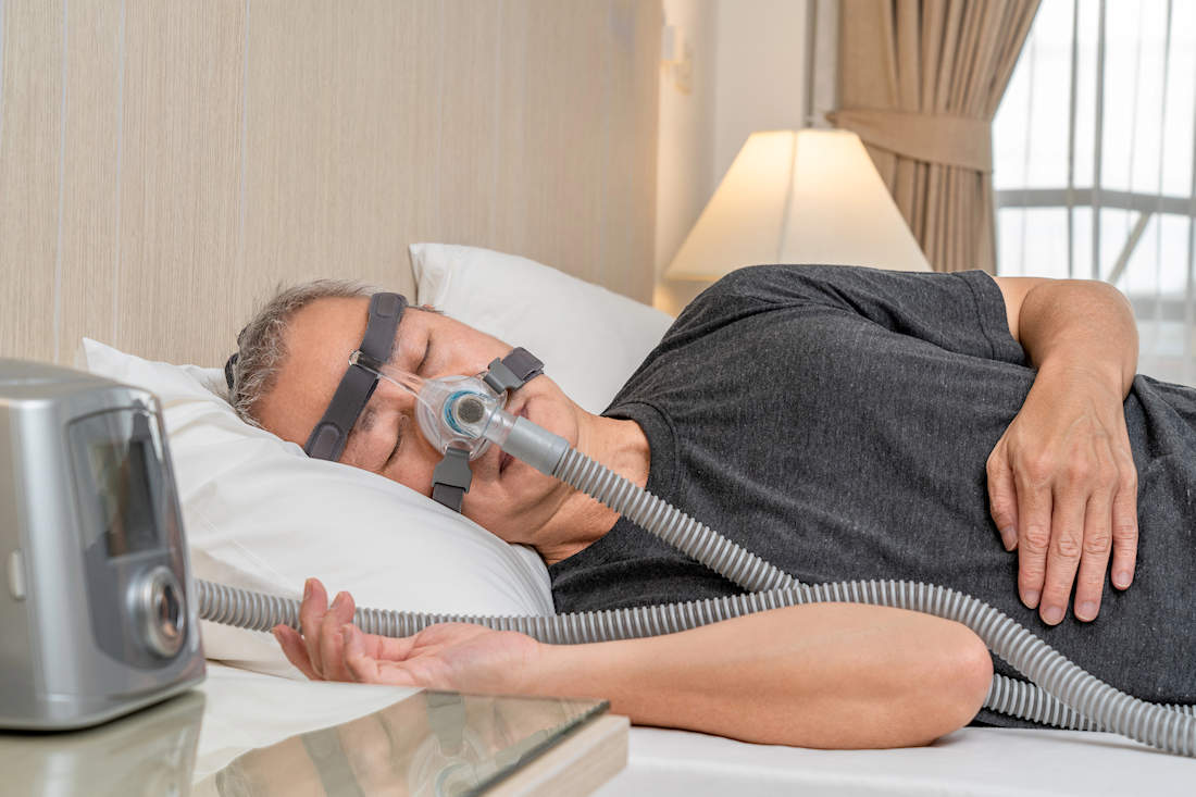 cpap per le apnee del sonno alternative