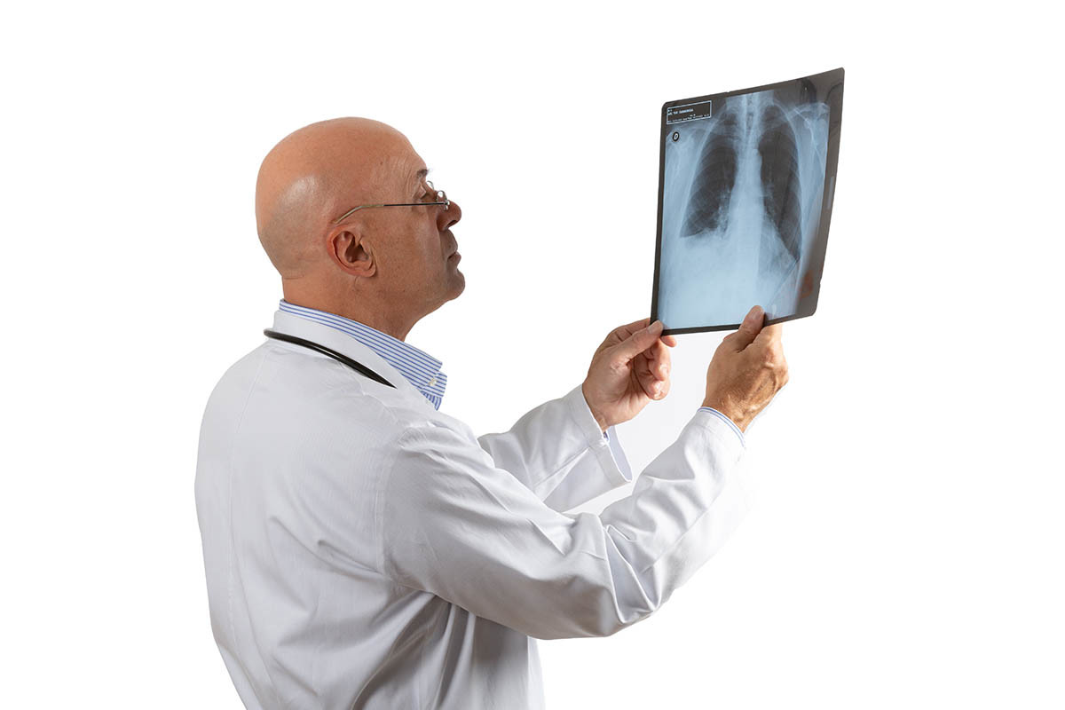 dott. Ballor che controlla una radiografia per sospetto di una polmonite
